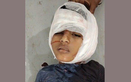 সাতকানিয়ায় গাছ কর্তনকারীদের ভুলে শিশুর মৃত্যু