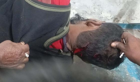 কুমিল্লায় জমিসংক্রান্ত বিরোধের জেরে ছুরিকাঘাতে নিহত ১