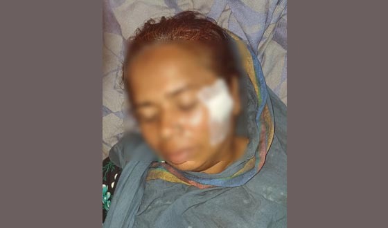 গাবতলীতে জমির বিরোধকে কেন্দ্রকরে বসতবাড়িতে হামলা, আহত ১