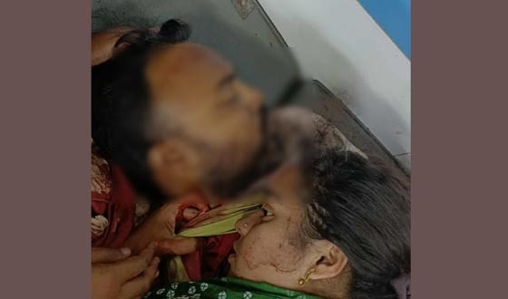 খুলনায় প্রকাশ্যে যুবদল নেতাকে গুলি করে হত্যা